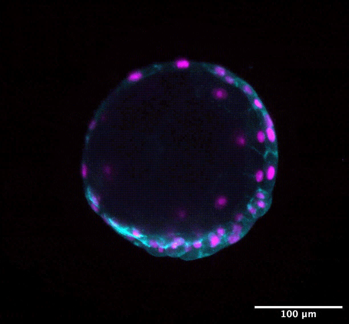 GIF of snail epiboly with membranes and histones marked