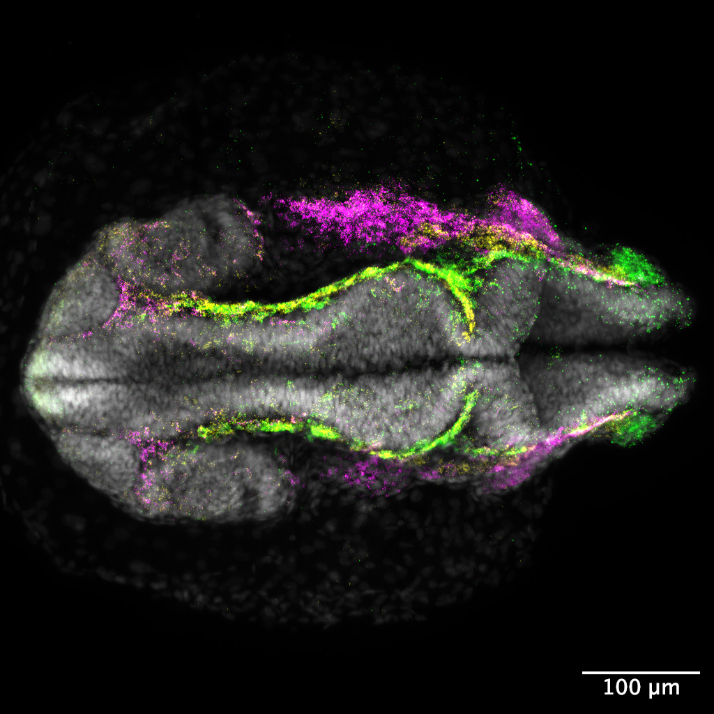 Microscopy image of stained zebrafish embryo