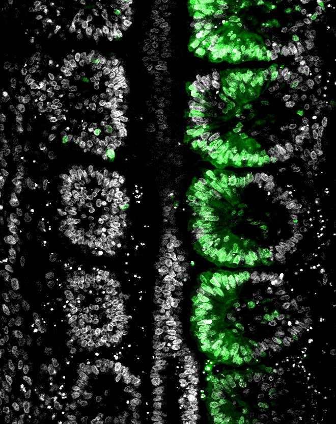 somite zproj RGB.jpg