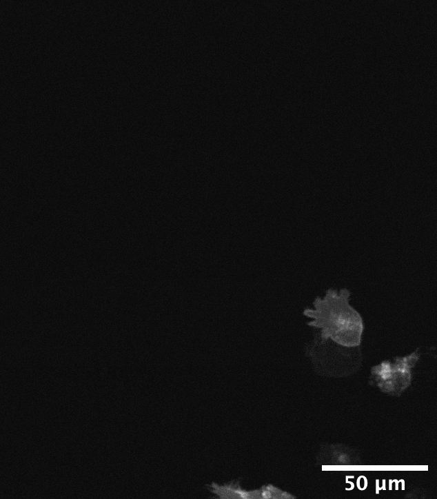 GIF of migrating cells marked by membrane GFP